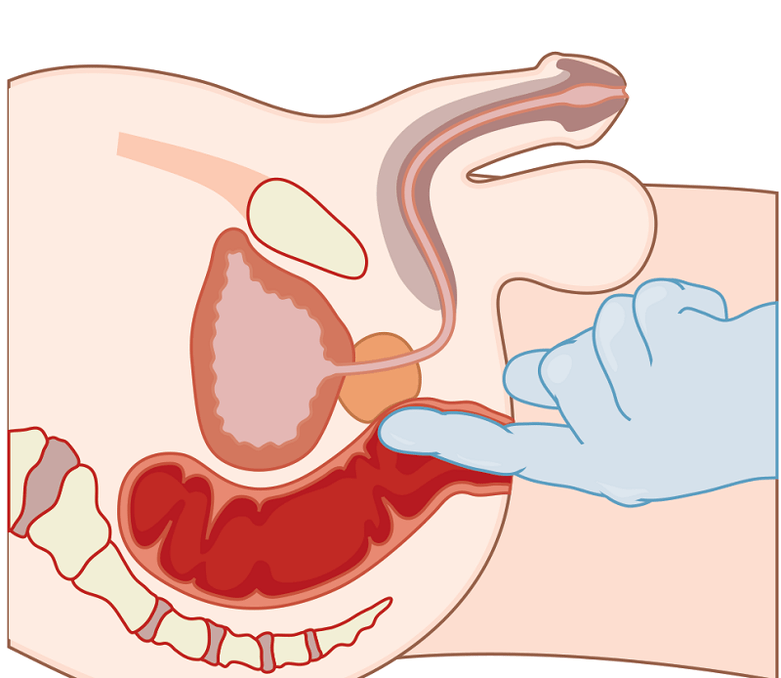 Prostate massage with prostatitis