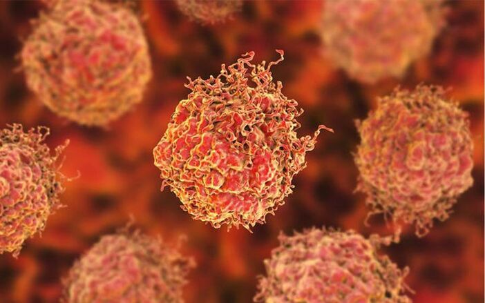 Prostate cancer cells